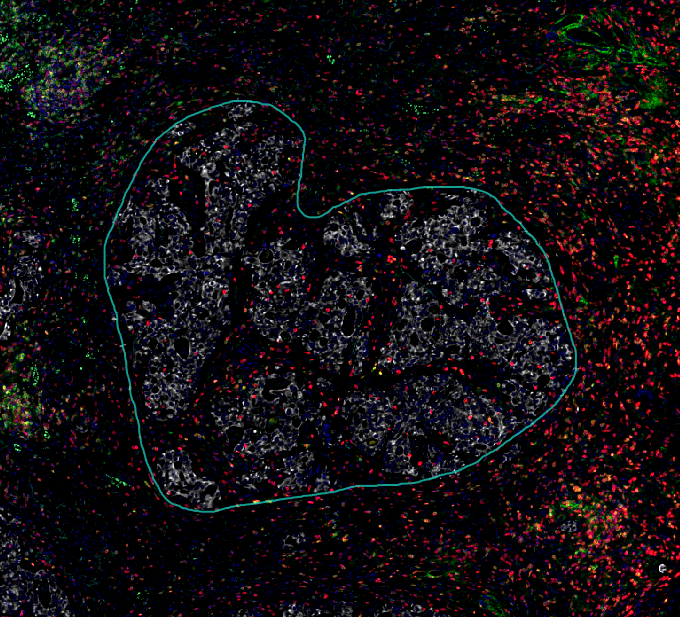 空间浸润分析-A