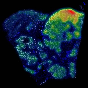 定量热图展示-B