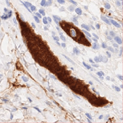 目标物定量分析-A