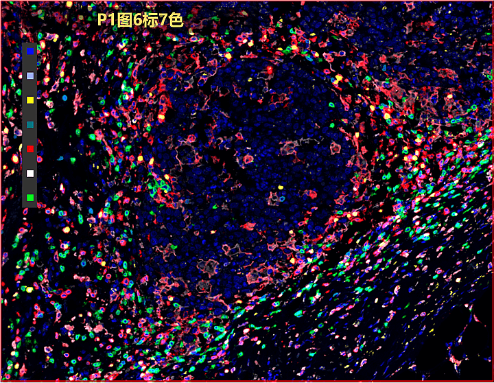 连续切片叠加分析-A