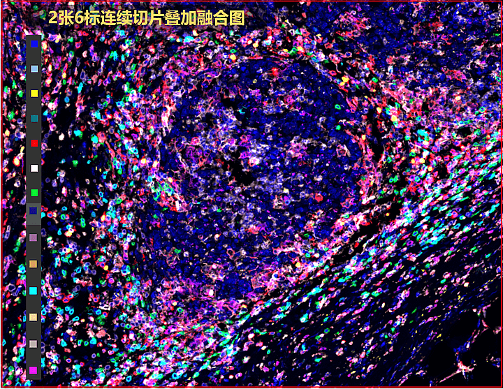 连续切片叠加分析-B
