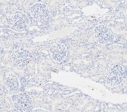 肾小球识别与分析-A