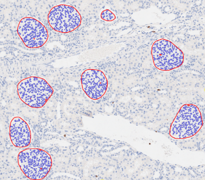 肾小球识别与分析-B