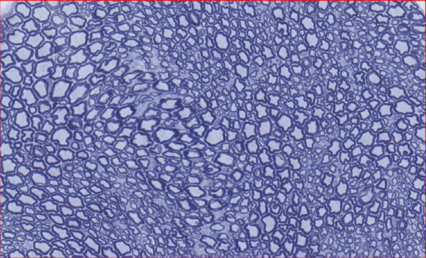 轴突定量分析-A