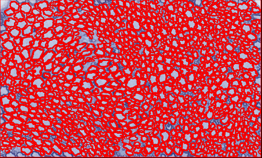 轴突定量分析-B